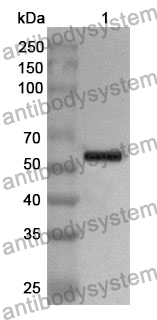 Anti-AKR1C4 Polyclonal Antibody