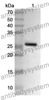 Anti-CTRB1 Polyclonal Antibody