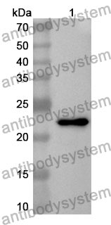 Anti-Human NDUFB7 Polyclonal Antibody