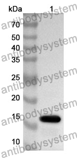 Anti-SYN1 Polyclonal Antibody