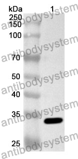 Anti-Human PRKACA Polyclonal Antibody