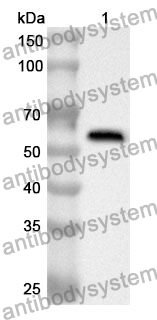 Anti-DES/Desmin Polyclonal Antibody