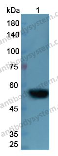 Anti-DES/Desmin Polyclonal Antibody