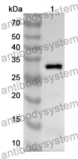 Anti-PTPN2 Polyclonal Antibody