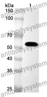 Anti-Human TPH1 Polyclonal Antibody