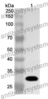 Anti-CHRNB2 Polyclonal Antibody