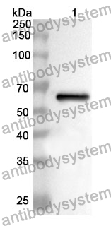 Anti-CD105/ENG Polyclonal Antibody