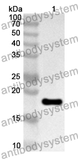 Anti-IGFBP3 Polyclonal Antibody