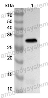 Anti-IGFBP3 Polyclonal Antibody