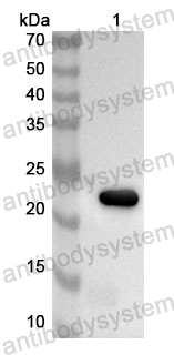 Anti-Human SPI1 Polyclonal Antibody