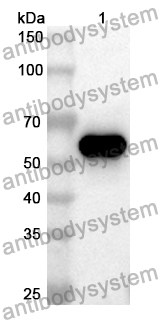 Anti-Human TCP1/CCTA Polyclonal Antibody