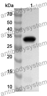 Anti-IGFBP2 Polyclonal Antibody