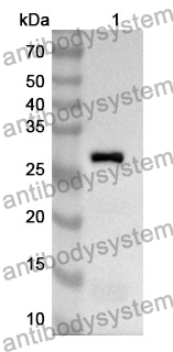 Anti-ITGB5 Polyclonal Antibody