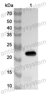 Anti-Human GABRB1 Polyclonal Antibody