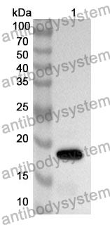 Anti-IL1RN Polyclonal Antibody