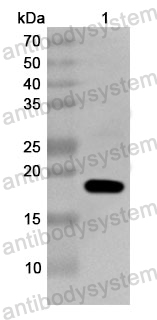 Anti-Human RPL17 Polyclonal Antibody