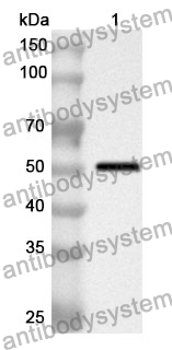 Anti-Human CD138/SDC1 Polyclonal Antibody