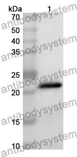 Anti-ATF6 Polyclonal Antibody