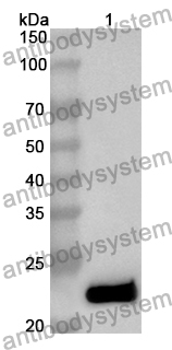 Anti-LIG1 Polyclonal Antibody