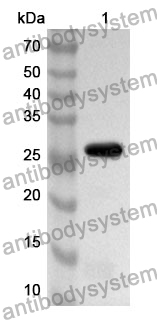 Anti-KRT15 Polyclonal Antibody