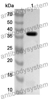 Anti-KRT4 Polyclonal Antibody