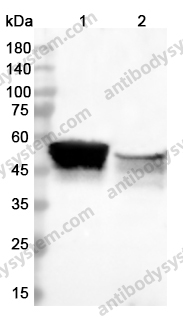 Anti-KRT4 Polyclonal Antibody