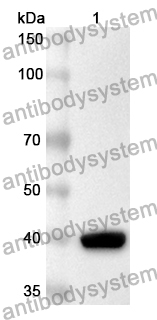 Anti-KRT4 Polyclonal Antibody