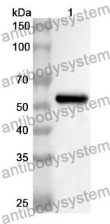 Anti-HDC Polyclonal Antibody