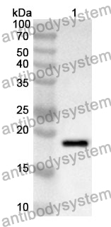 Anti-TNNI1 Polyclonal Antibody