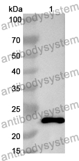 Anti-NCL Polyclonal Antibody