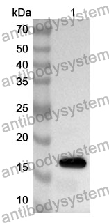 Anti-HK1 Polyclonal Antibody