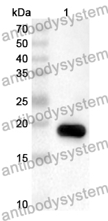 Anti-Human NDUFV2 Polyclonal Antibody