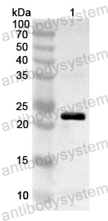 Anti-Human ELK1 Polyclonal Antibody