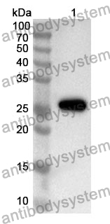 Anti-TNNI3 Polyclonal Antibody