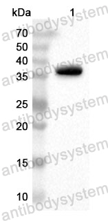 Anti-Human CD120a/TNFRSF1A/TNFR1 Polyclonal Antibody