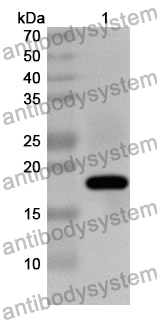 Anti-WT1 Polyclonal Antibody