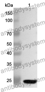 Anti-ORM2 Polyclonal Antibody