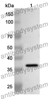 Anti-AOC1/DAO Polyclonal Antibody