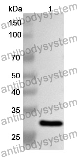 Anti-ITIH2 Polyclonal Antibody