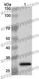 Anti-Human CEL Polyclonal Antibody