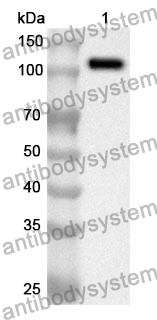 Anti-NFKB1 Polyclonal Antibody