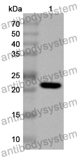 Anti-NCF2 Polyclonal Antibody