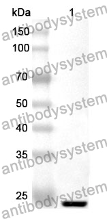 Anti-TYMP Polyclonal Antibody