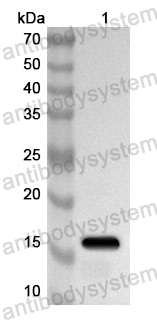 Anti-Human EIF2S2 Polyclonal Antibody