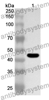 Anti-Human TCN1 Polyclonal Antibody