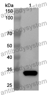 Anti-ANXA7 Polyclonal Antibody