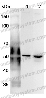 Anti-ANXA7 Polyclonal Antibody