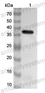 Anti-Human PGC/Gastricsin Polyclonal Antibody