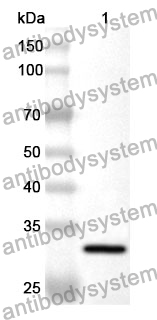 Anti-KLK2 Polyclonal Antibody