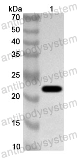 Anti-Human POU3F2 Polyclonal Antibody